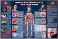 Электрифицированный стенд "Вредные привычки: алкоголизм" - «globural.ru» - Нерюнгри