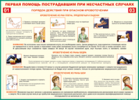Таблица Порядок действий при опасном кровотечении 1000*1400 винил - «globural.ru» - Нерюнгри