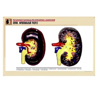 Рельефная таблица "Почка. Фронтальный разрез" (формат А1, матовое ламинир.) - «globural.ru» - Нерюнгри